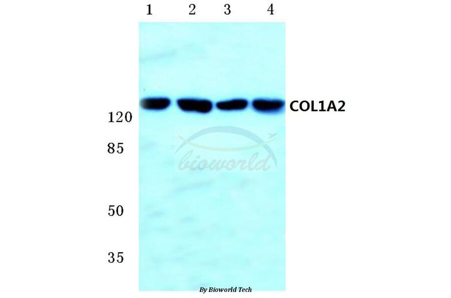 Anti-COL1A2 (S3) Antibody from Bioworld Technology (BS1530) - Antibodies.com