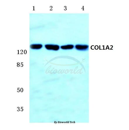 Anti-COL1A2 (S3) Antibody from Bioworld Technology (BS1530) - Antibodies.com