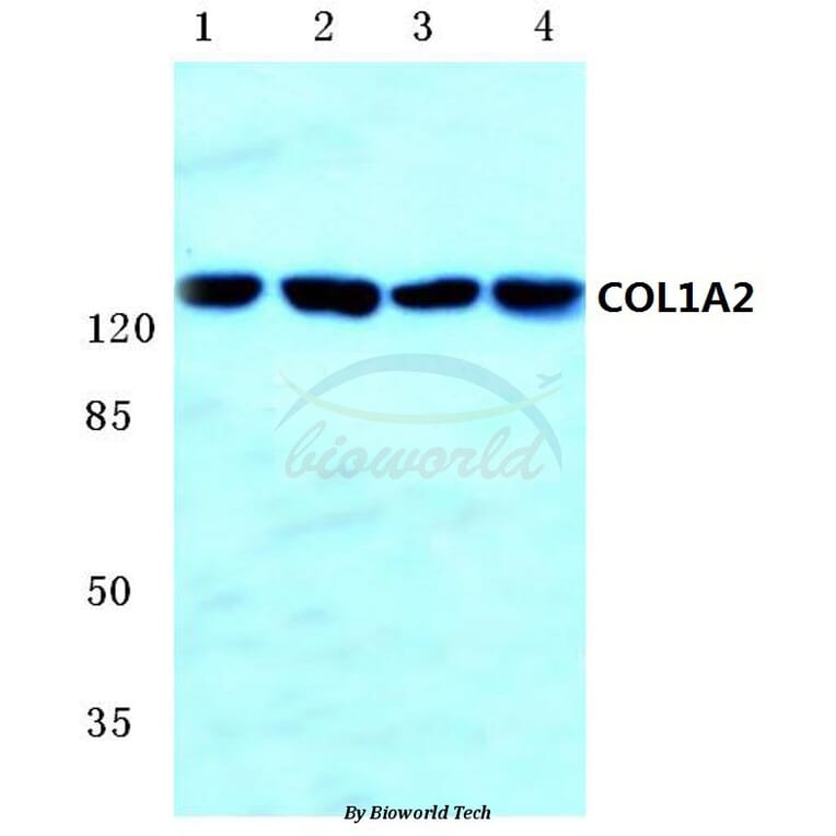 Anti-COL1A2 (S3) Antibody from Bioworld Technology (BS1530) - Antibodies.com