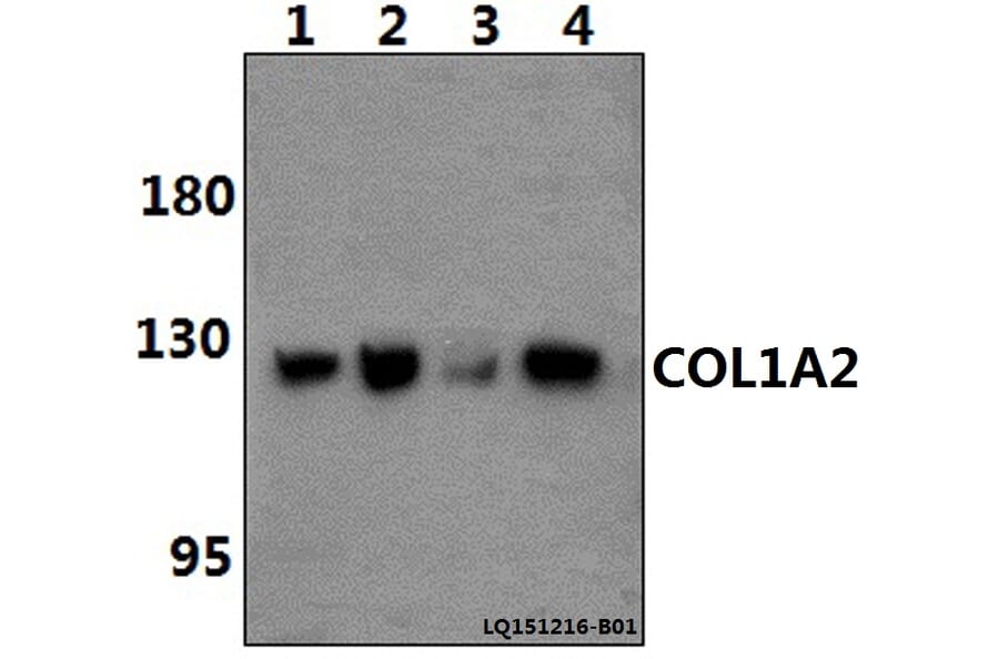 Anti-COL1A2 (S3) Antibody from Bioworld Technology (BS1530) - Antibodies.com