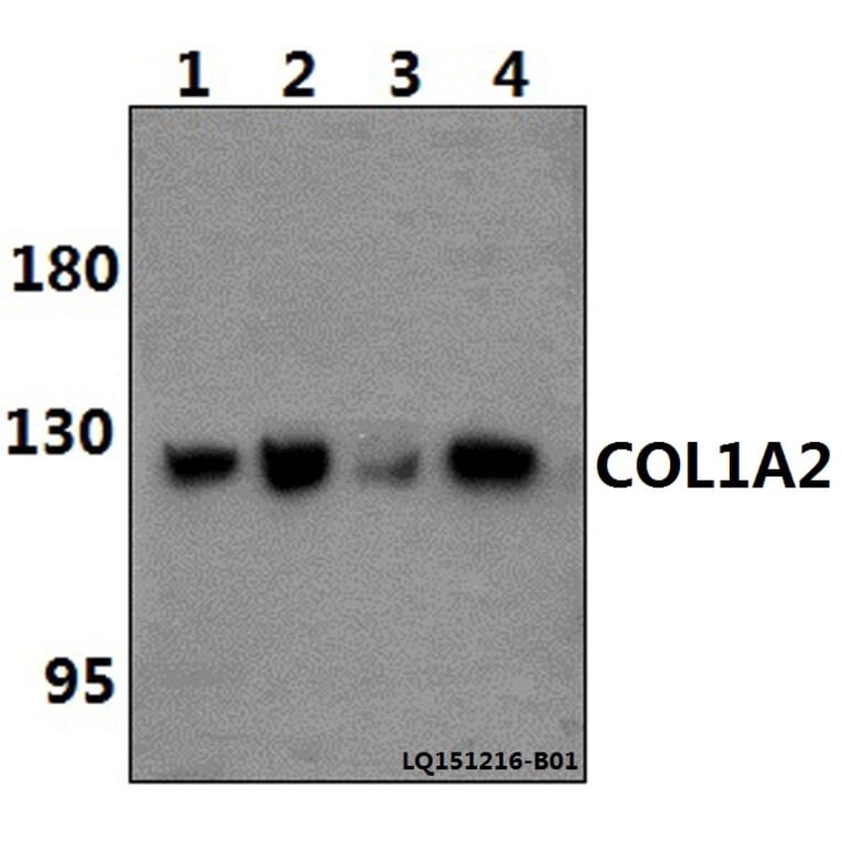 Anti-COL1A2 (S3) Antibody from Bioworld Technology (BS1530) - Antibodies.com