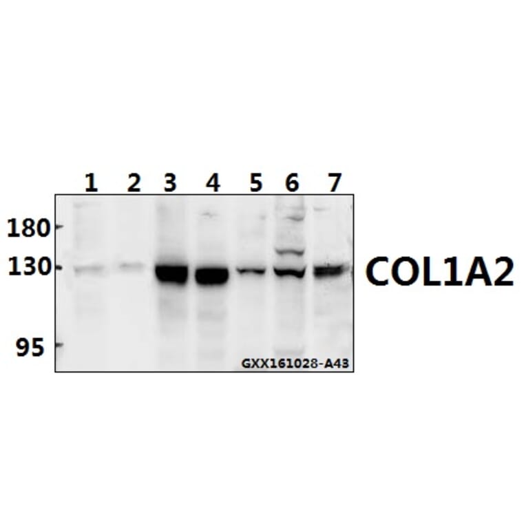 Anti-COL1A2 (S3) Antibody from Bioworld Technology (BS1530) - Antibodies.com