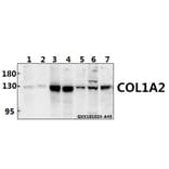 Anti-COL1A2 (S3) Antibody from Bioworld Technology (BS1530) - Antibodies.com