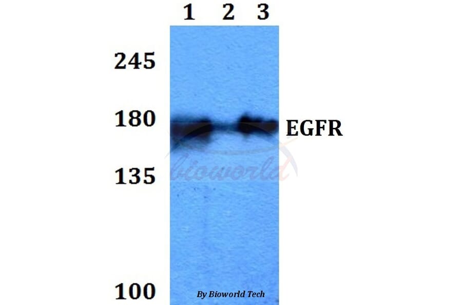 Anti-EGFR (V1010) Antibody from Bioworld Technology (BS1533) - Antibodies.com