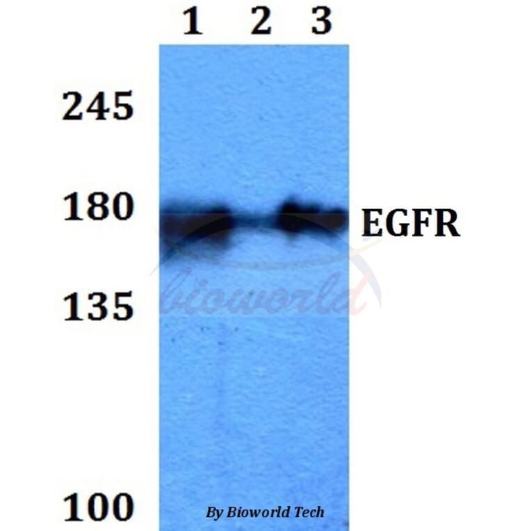 Anti-EGFR (V1010) Antibody from Bioworld Technology (BS1533) - Antibodies.com