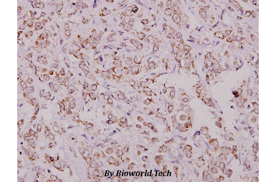 Anti-eIF4G (Q1103) Antibody from Bioworld Technology (BS1534) - Antibodies.com
