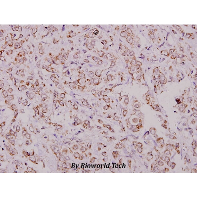 Anti-eIF4G (Q1103) Antibody from Bioworld Technology (BS1534) - Antibodies.com