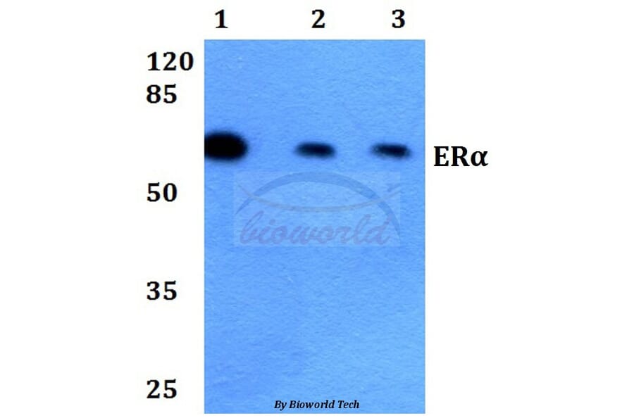 Anti-ERα (K531) Antibody from Bioworld Technology (BS1535) - Antibodies.com