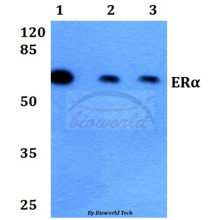 Anti-ERα (K531) Antibody from Bioworld Technology (BS1535) - Antibodies.com