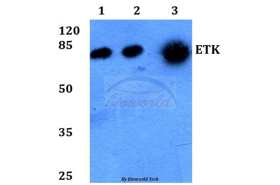Anti-ETK (K35) Antibody from Bioworld Technology (BS1536) - Antibodies.com