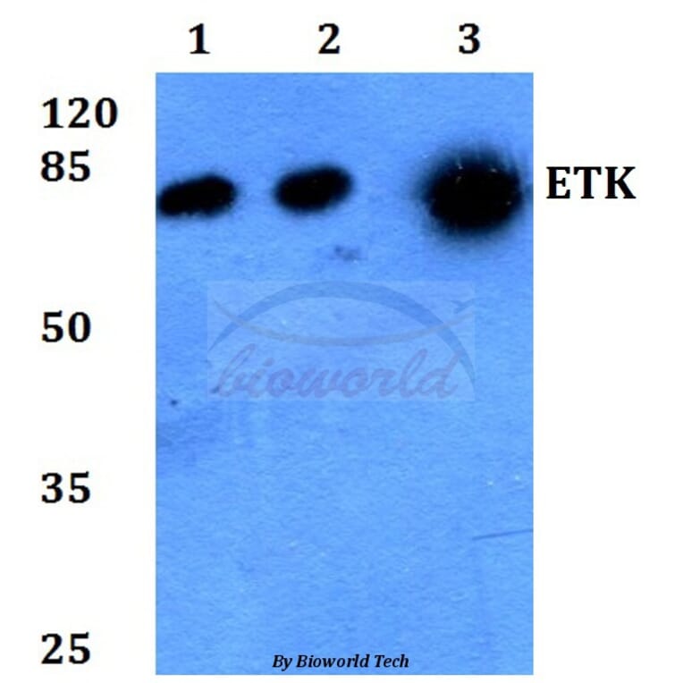 Anti-ETK (K35) Antibody from Bioworld Technology (BS1536) - Antibodies.com