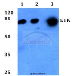 Anti-ETK (K35) Antibody from Bioworld Technology (BS1536) - Antibodies.com