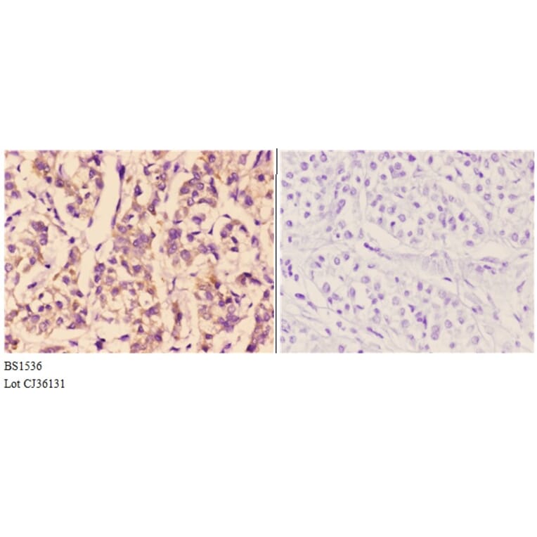 Anti-ETK (K35) Antibody from Bioworld Technology (BS1536) - Antibodies.com