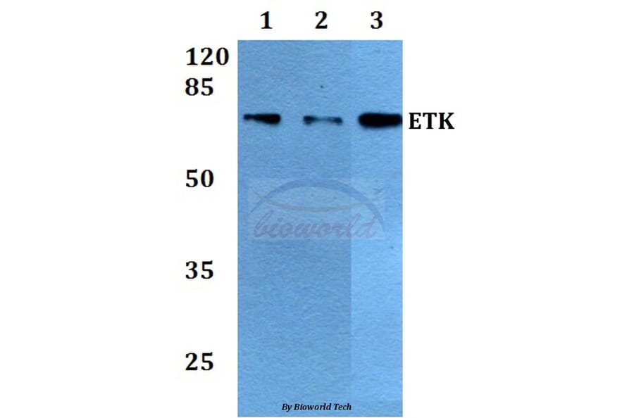 Anti-ETK (L562) Antibody from Bioworld Technology (BS1537) - Antibodies.com