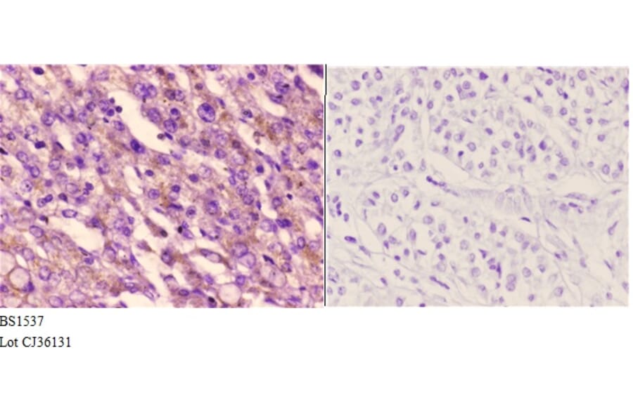 Anti-ETK (L562) Antibody from Bioworld Technology (BS1537) - Antibodies.com