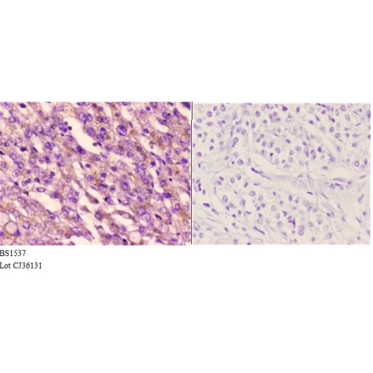 Anti-ETK (L562) Antibody from Bioworld Technology (BS1537) - Antibodies.com