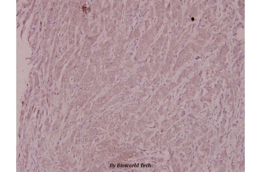 Anti-IKKβ (L193) Antibody from Bioworld Technology (BS1540) - Antibodies.com