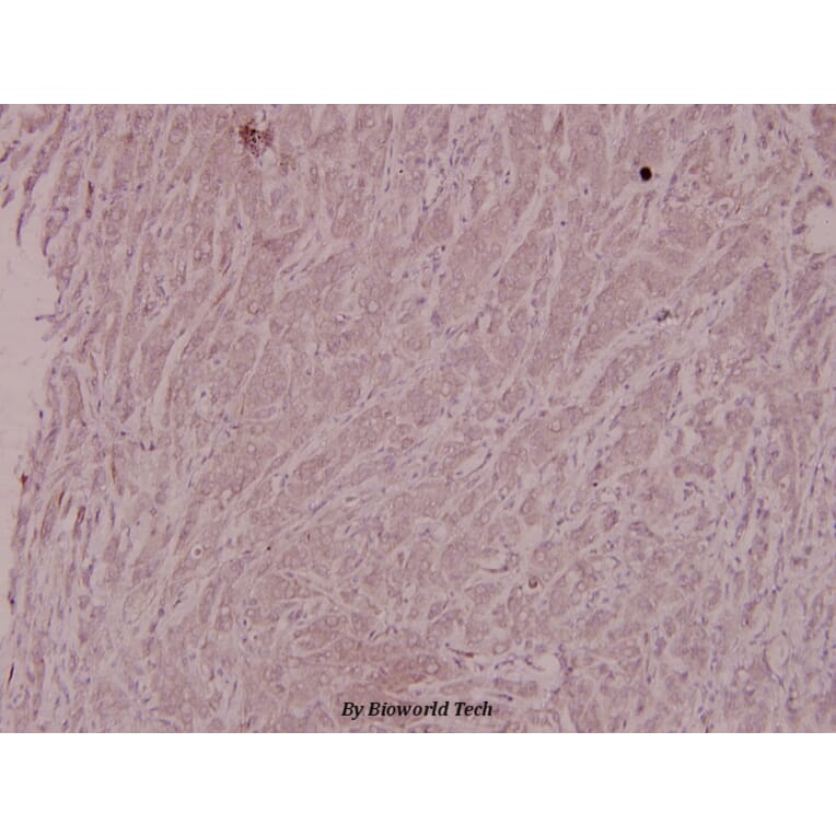 Anti-IKKβ (L193) Antibody from Bioworld Technology (BS1540) - Antibodies.com