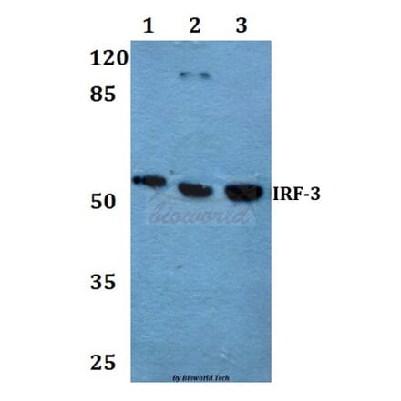 Anti-IRF-3 (A379) Antibody from Bioworld Technology (BS1542) - Antibodies.com