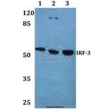 Anti-IRF-3 (A379) Antibody from Bioworld Technology (BS1542) - Antibodies.com