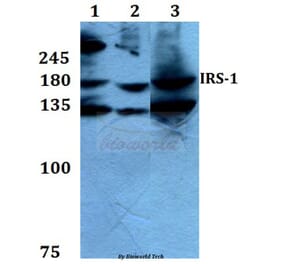 Anti-IRS-1 (L789) Antibody from Bioworld Technology (BS1543) - Antibodies.com