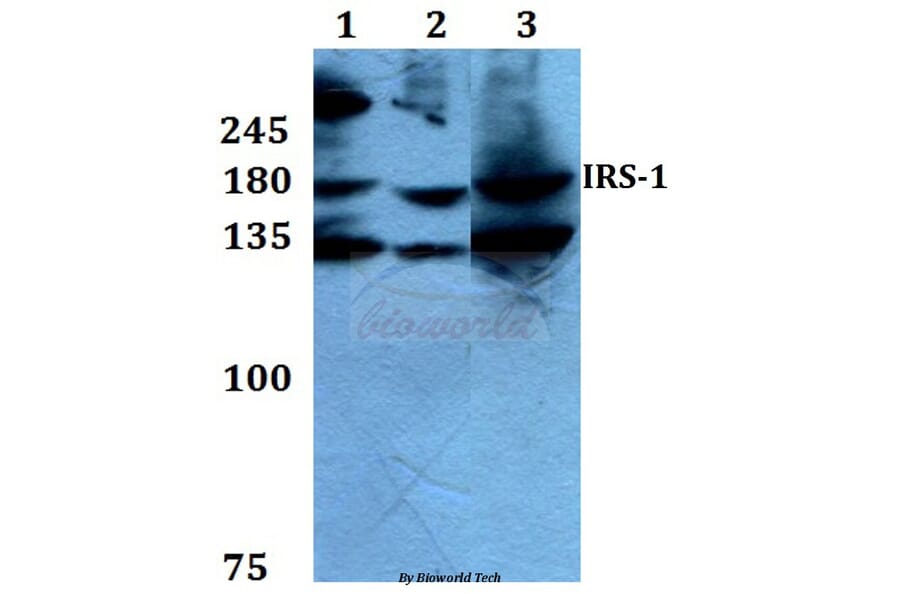 Anti-IRS-1 (L789) Antibody from Bioworld Technology (BS1543) - Antibodies.com
