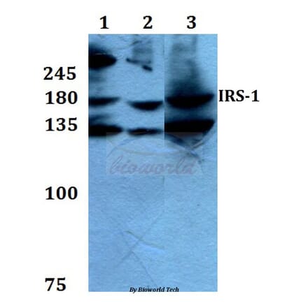 Anti-IRS-1 (L789) Antibody from Bioworld Technology (BS1543) - Antibodies.com