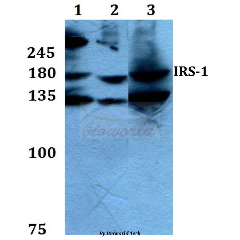 Anti-IRS-1 (L789) Antibody from Bioworld Technology (BS1543) - Antibodies.com