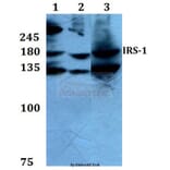 Anti-IRS-1 (L789) Antibody from Bioworld Technology (BS1543) - Antibodies.com