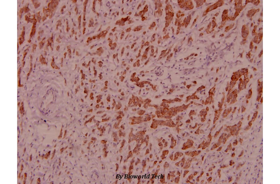 Anti-IRS-1 (L789) Antibody from Bioworld Technology (BS1543) - Antibodies.com