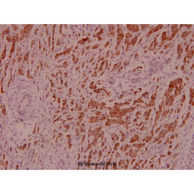 Anti-IRS-1 (L789) Antibody from Bioworld Technology (BS1543) - Antibodies.com