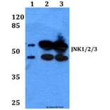 Anti-JNK1/2/3 (P184) Antibody from Bioworld Technology (BS1544) - Antibodies.com