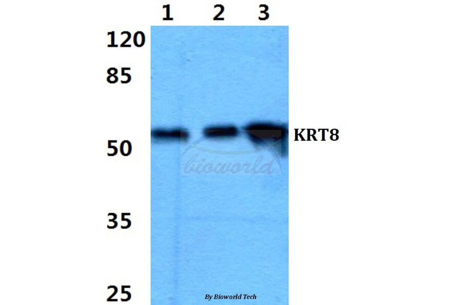 Anti-Cytokeratin 8 (G427) Antibody from Bioworld Technology (BS1545) - Antibodies.com