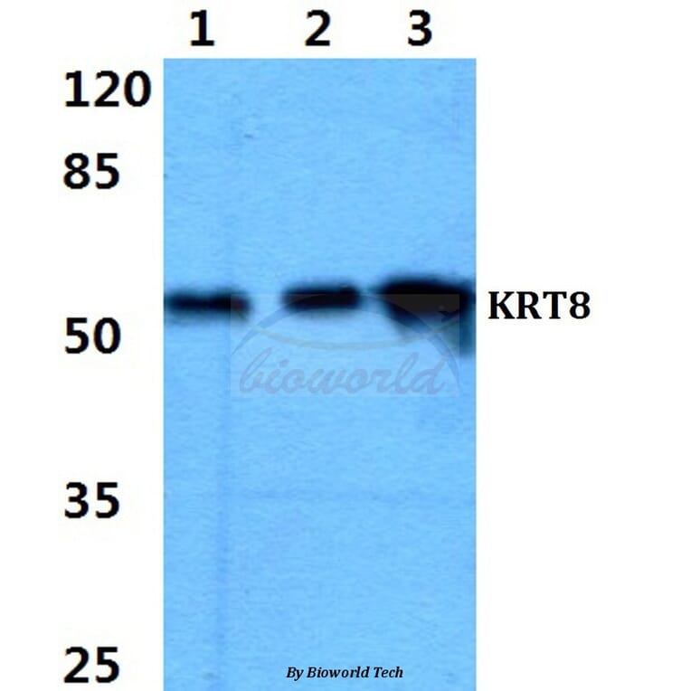 Anti-Cytokeratin 8 (G427) Antibody from Bioworld Technology (BS1545) - Antibodies.com