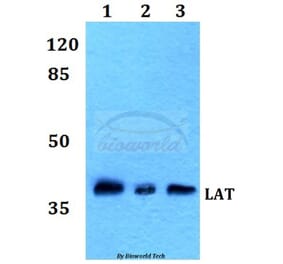 Anti-LAT (L185) Antibody from Bioworld Technology (BS1547) - Antibodies.com