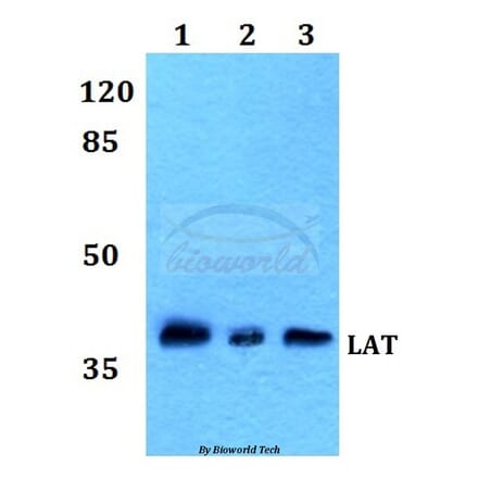 Anti-LAT (L185) Antibody from Bioworld Technology (BS1547) - Antibodies.com