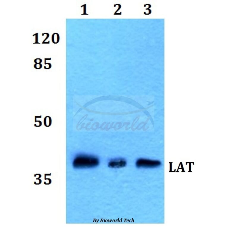 Anti-LAT (L185) Antibody from Bioworld Technology (BS1547) - Antibodies.com