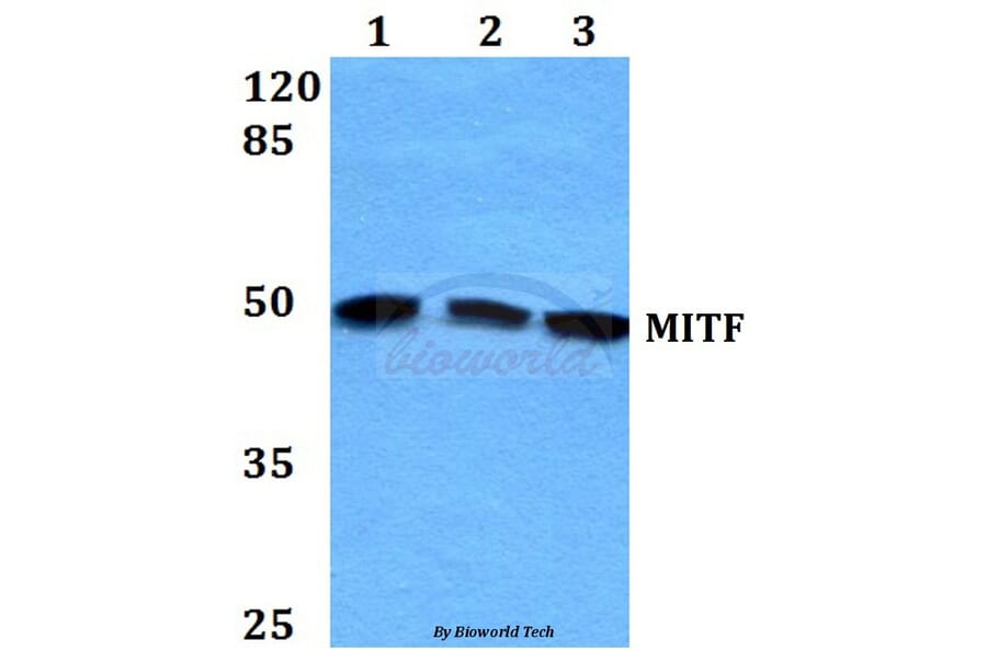 Anti-MITF (G174) Antibody from Bioworld Technology (BS1550) - Antibodies.com