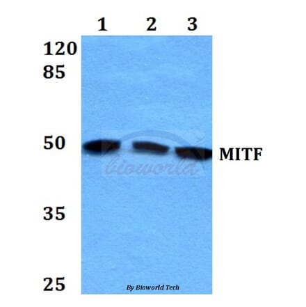 Anti-MITF (G174) Antibody from Bioworld Technology (BS1550) - Antibodies.com