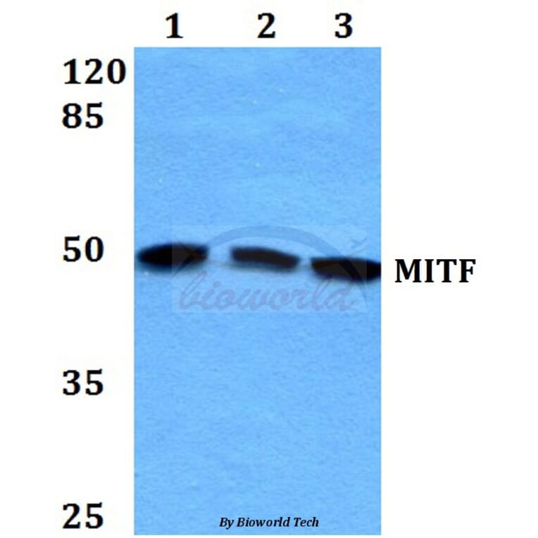 Anti-MITF (G174) Antibody from Bioworld Technology (BS1550) - Antibodies.com