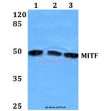 Anti-MITF (G174) Antibody from Bioworld Technology (BS1550) - Antibodies.com