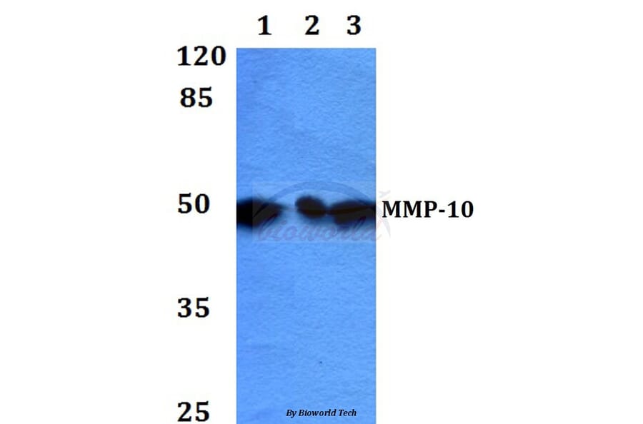 Anti-MMP-10 (I387) Antibody from Bioworld Technology (BS1551) - Antibodies.com