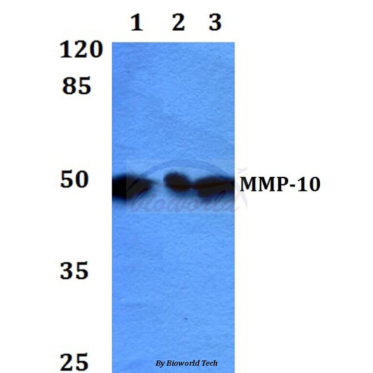 Anti-MMP-10 (I387) Antibody from Bioworld Technology (BS1551) - Antibodies.com