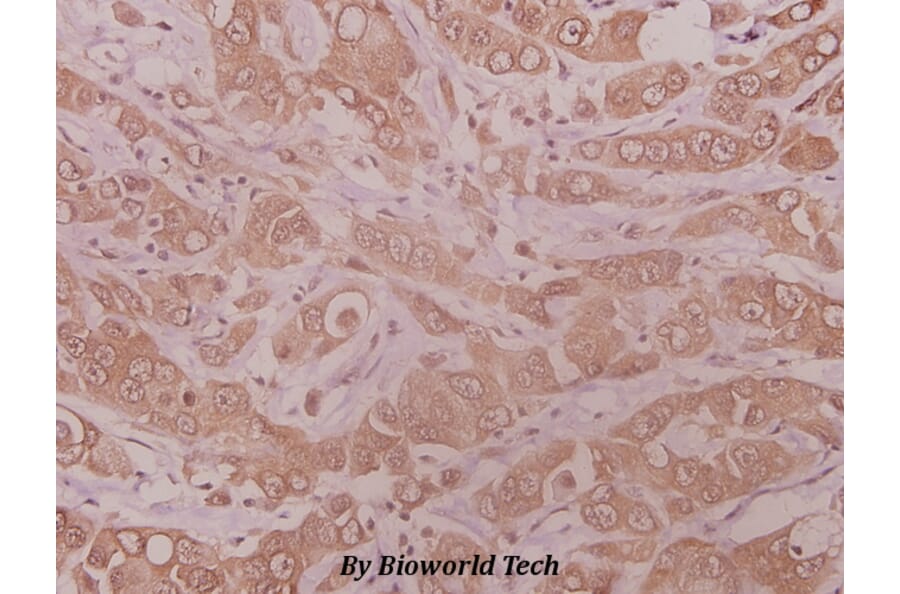 Anti-MMP-10 (I387) Antibody from Bioworld Technology (BS1551) - Antibodies.com
