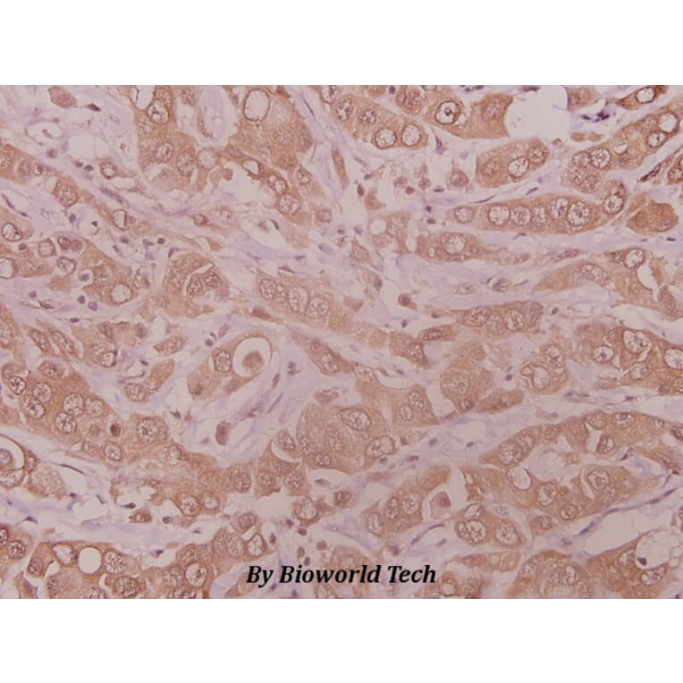 Anti-MMP-10 (I387) Antibody from Bioworld Technology (BS1551) - Antibodies.com