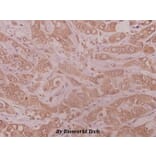 Anti-MMP-10 (I387) Antibody from Bioworld Technology (BS1551) - Antibodies.com