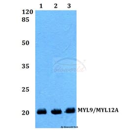 Anti-MYL9/MYL12A (P13) Antibody from Bioworld Technology (BS1552) - Antibodies.com