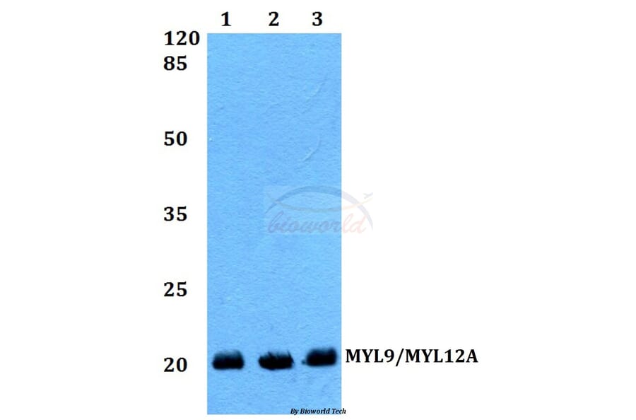 Anti-MYL9/MYL12A (P13) Antibody from Bioworld Technology (BS1552) - Antibodies.com