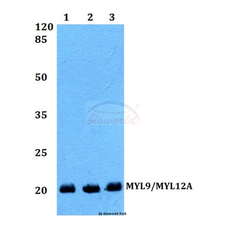 Anti-MYL9/MYL12A (P13) Antibody from Bioworld Technology (BS1552) - Antibodies.com