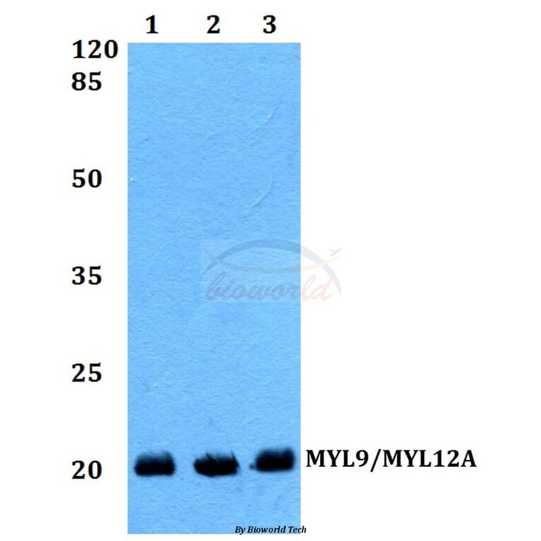 Anti-MYL9/MYL12A (P13) Antibody from Bioworld Technology (BS1552) - Antibodies.com